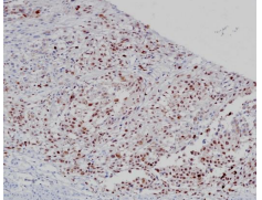 PRAME Rabbit Monoclonal Antibody(ARB532)