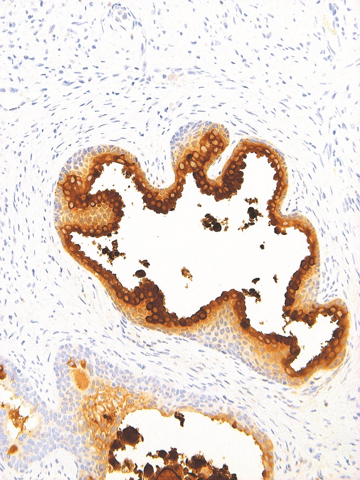 PSA Mouse Monoclonal Antibody(ARM895)
