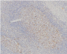 TIGIT Rabbit Monoclonal Antibody(ARB560)