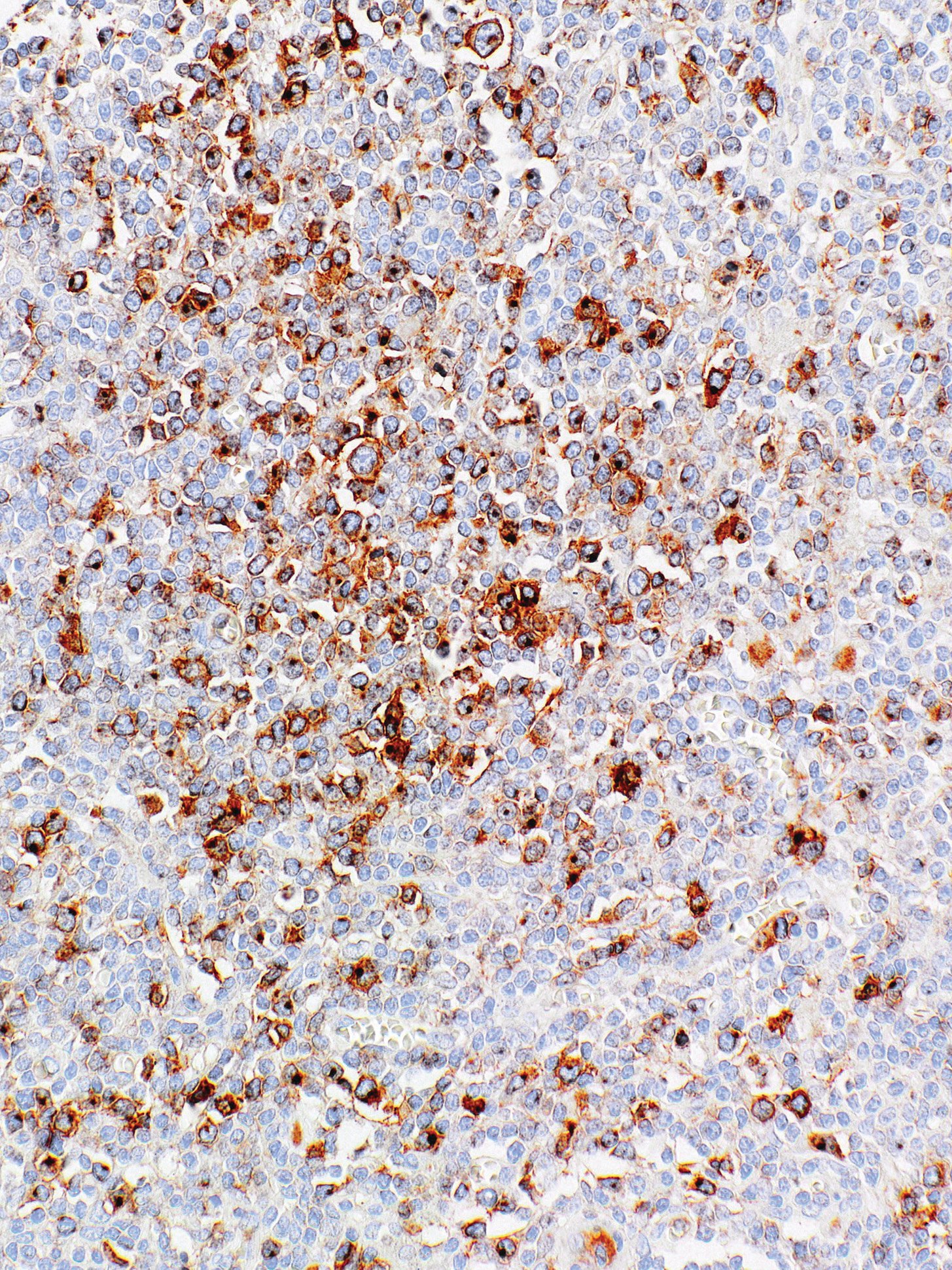 CD30 Mouse Monoclonal Antibody(ARM872)