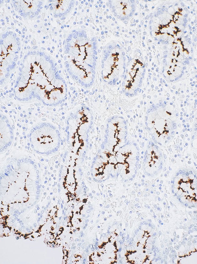 Helicobacter pylori Rabbit Monoclonal Antibody(ARM881)