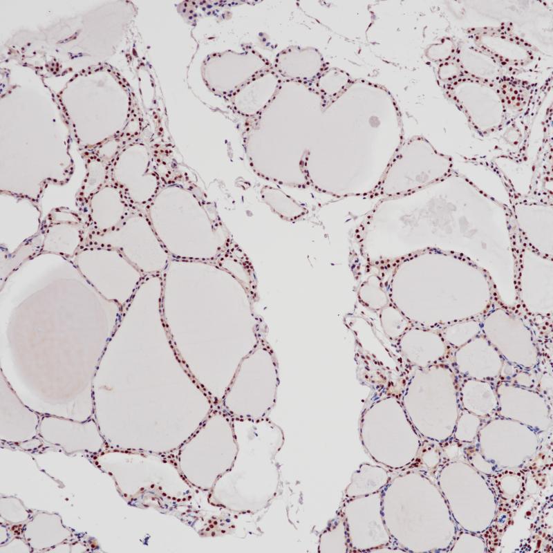 Parafibromin Rabbit Monoclonal Antibody(ARB519)