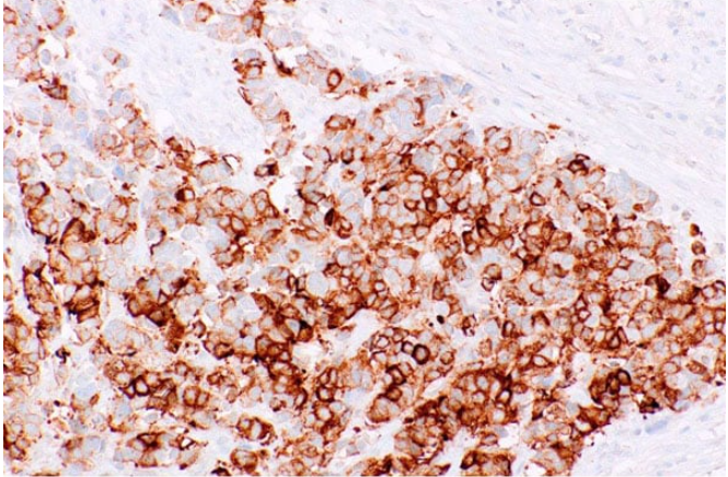 Synaptophysin Mouse Monoclonal Antibody(ARM896)