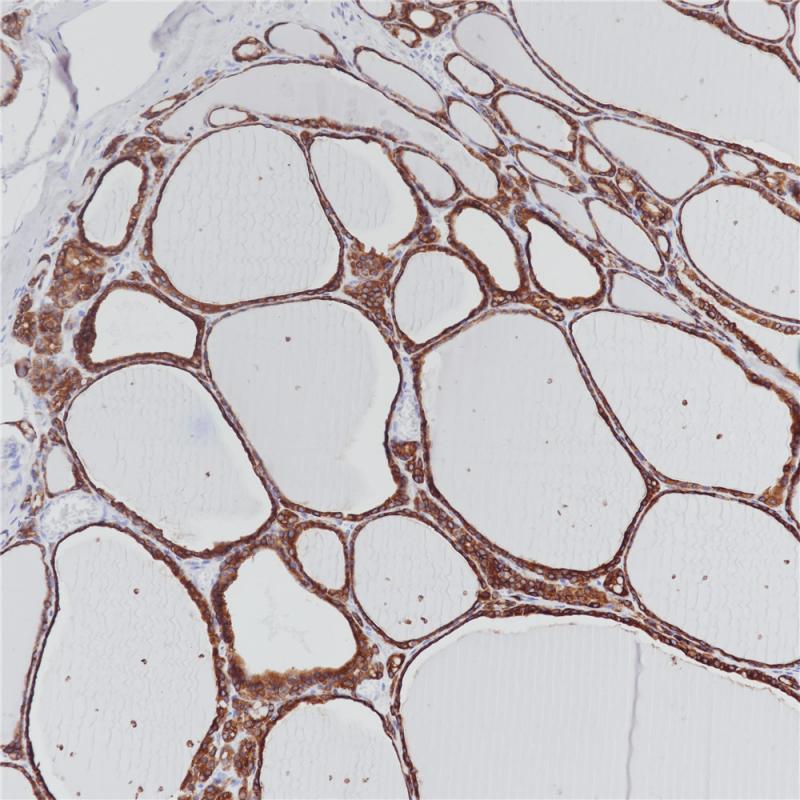 TPO Mouse Monoclonal Antibody(ARB565)