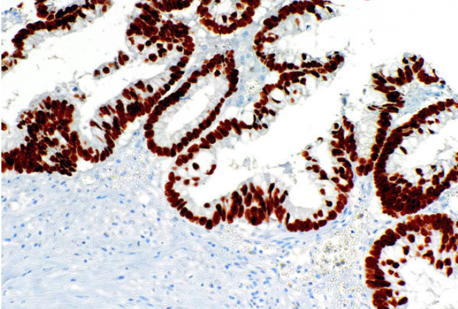 FOXA1 Mouse Monoclonal Antibody(ARM906)