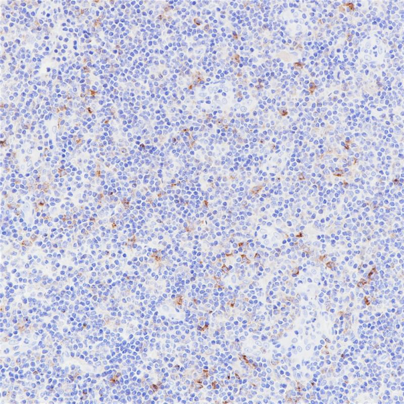 Tim-3 Rabbit Monoclonal Antibody(ARB561)