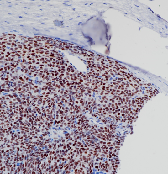 TLE1 Rabbit Monoclonal Antibody(ARB562)