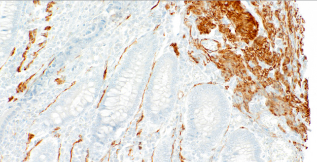Myosin, Smooth Muscle Mouse Monoclonal Antibody(ARM868)