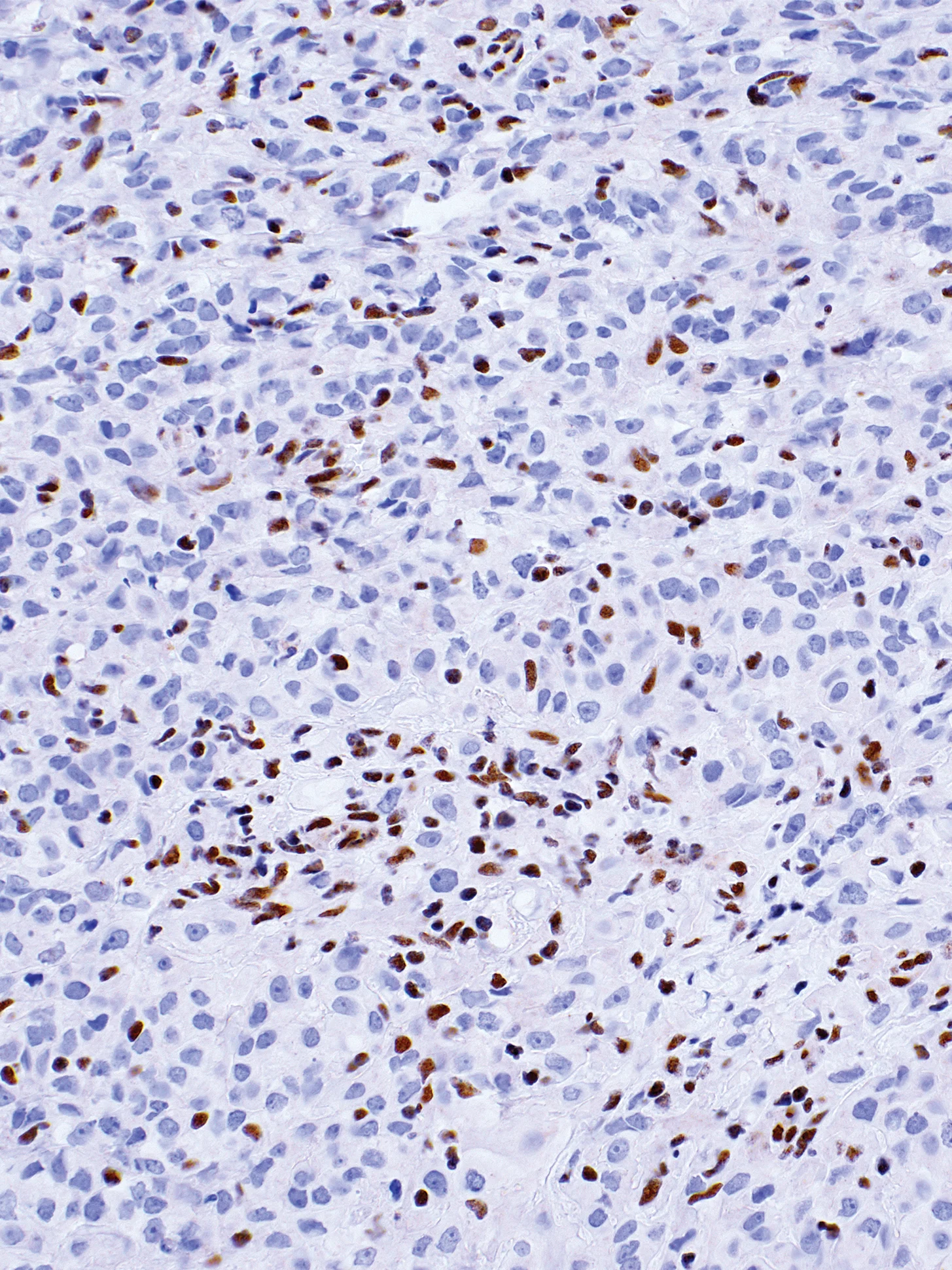 BAP1 Mouse Monoclonal Antibody(ARM899)
