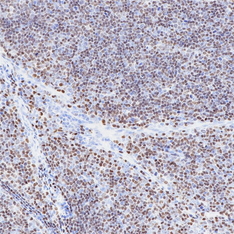 TdT Rabbit Monoclonal Antibody(ARB556)