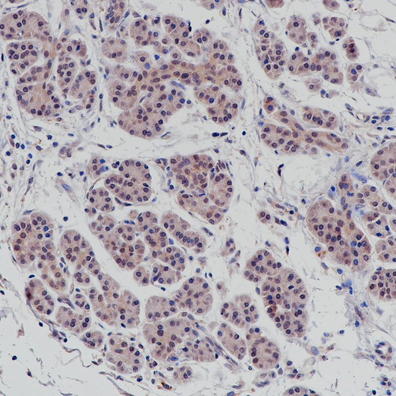 SMAD4 Rabbit Monoclonal Antibody(ARB547)