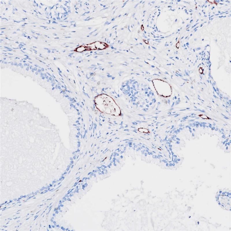 Von Willebrand Factor (VWF)Rabbit Monoclonal Antibody(ARB571)
