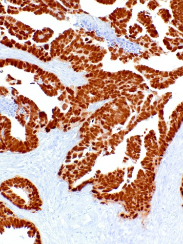 PAX-8 Rabbit Monoclonal Antibody(ARM863)