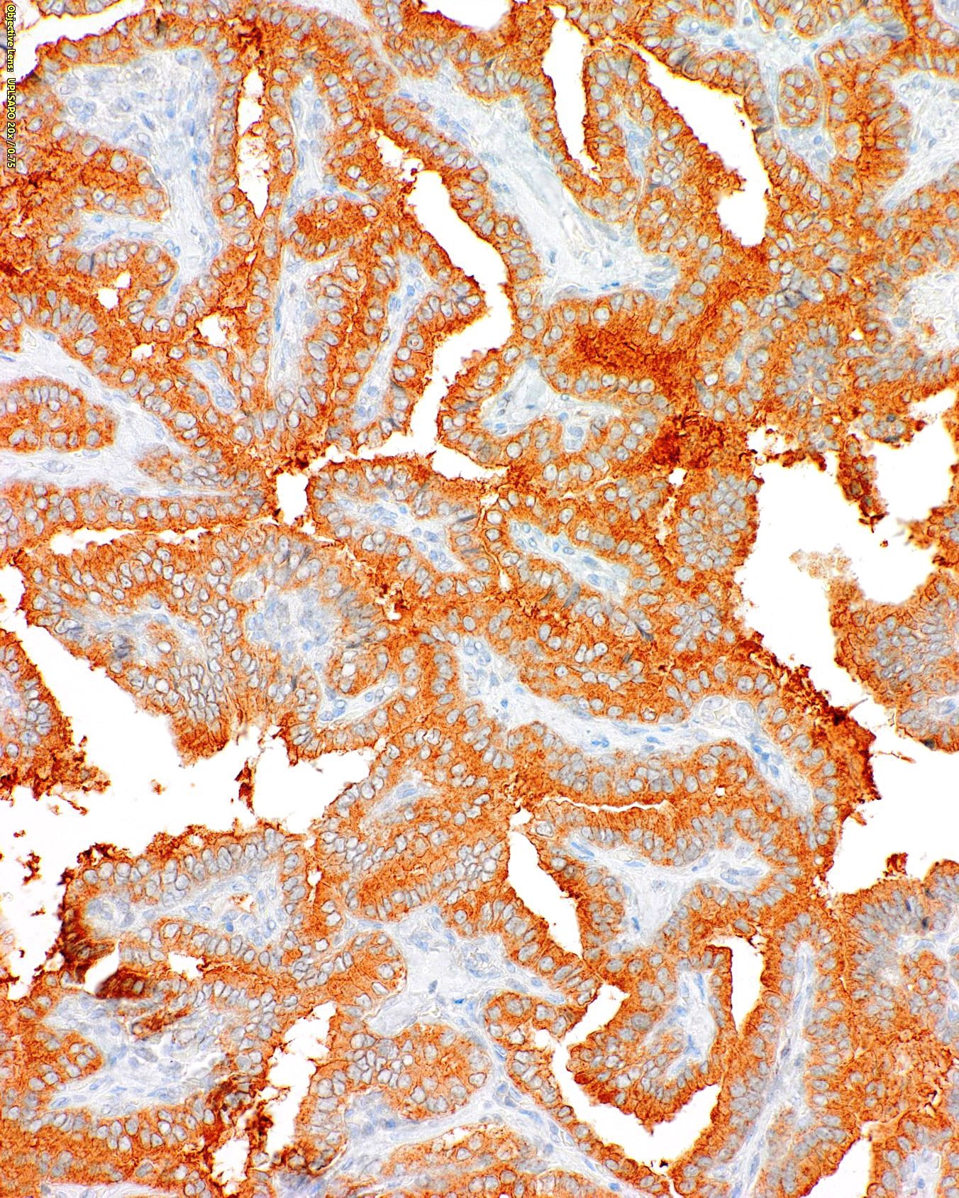 BRAF V600E Mouse Monoclonal Antibody(ARM892)