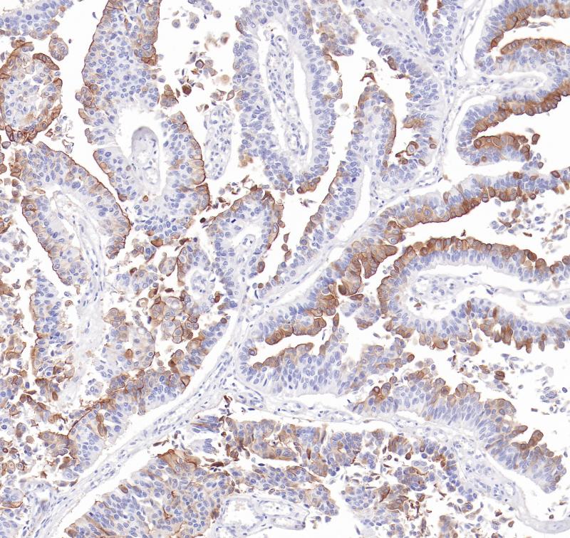 Uroplakin 1a（UPK1A) Rabbit Monoclonal Antibody(ARB567)