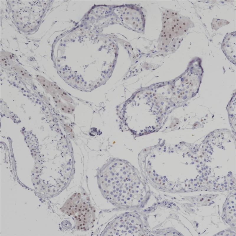 TFE3 Rabbit Monoclonal Antibody(ARB557)