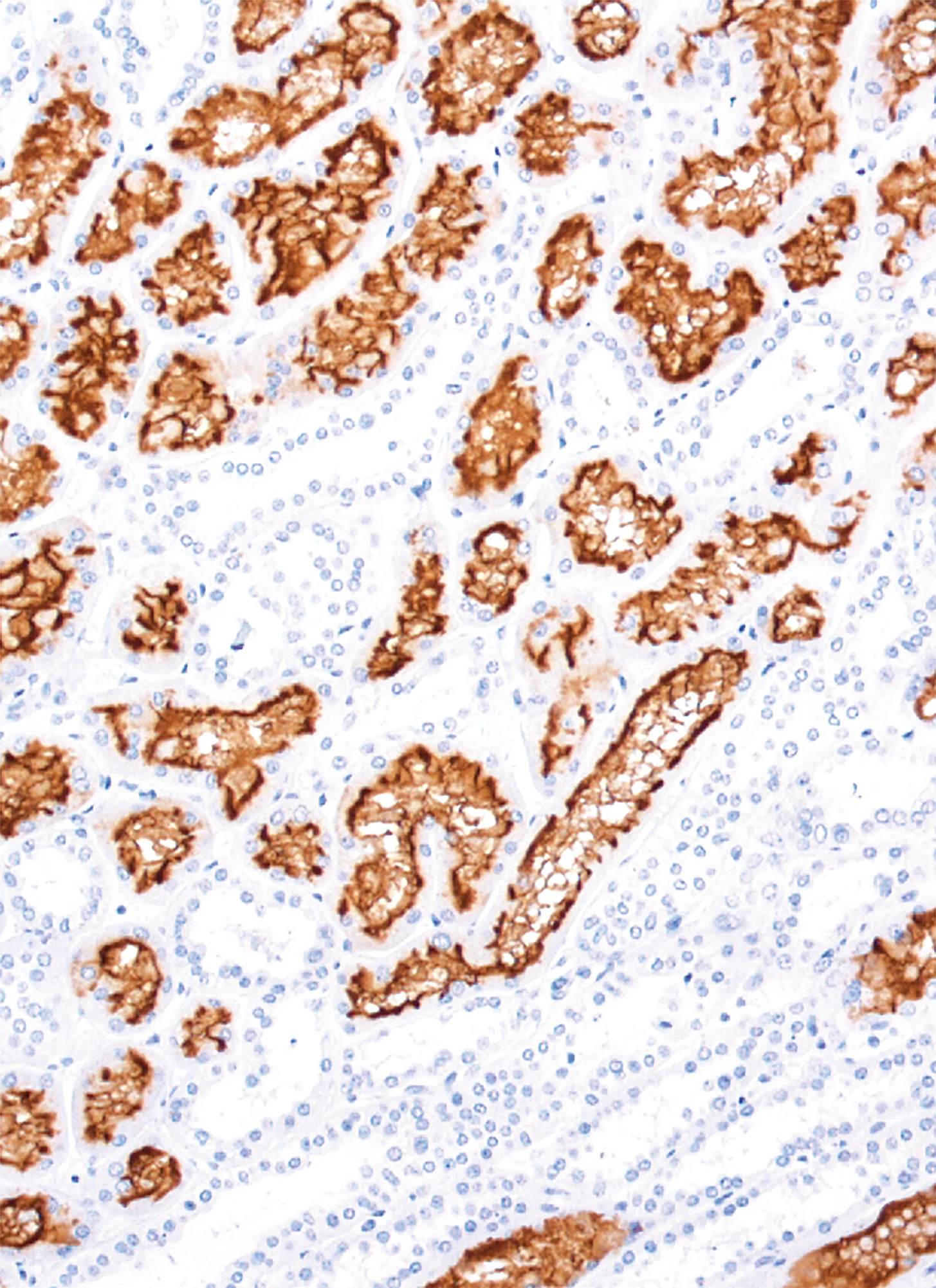 CD10 Rabbit Monoclonal Antibody(ARM886)