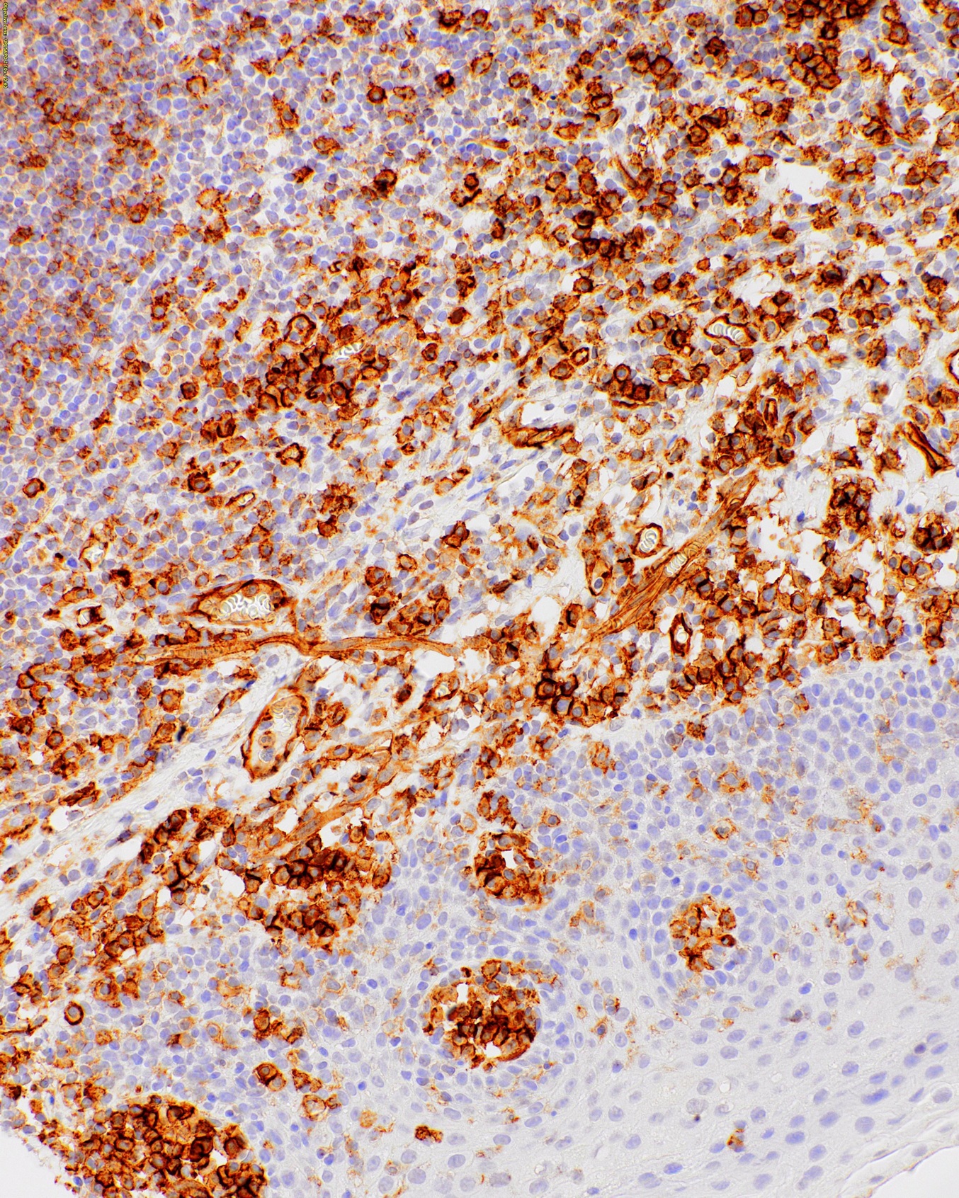 CD31 Mouse Monoclonal Antibody(ARM861)