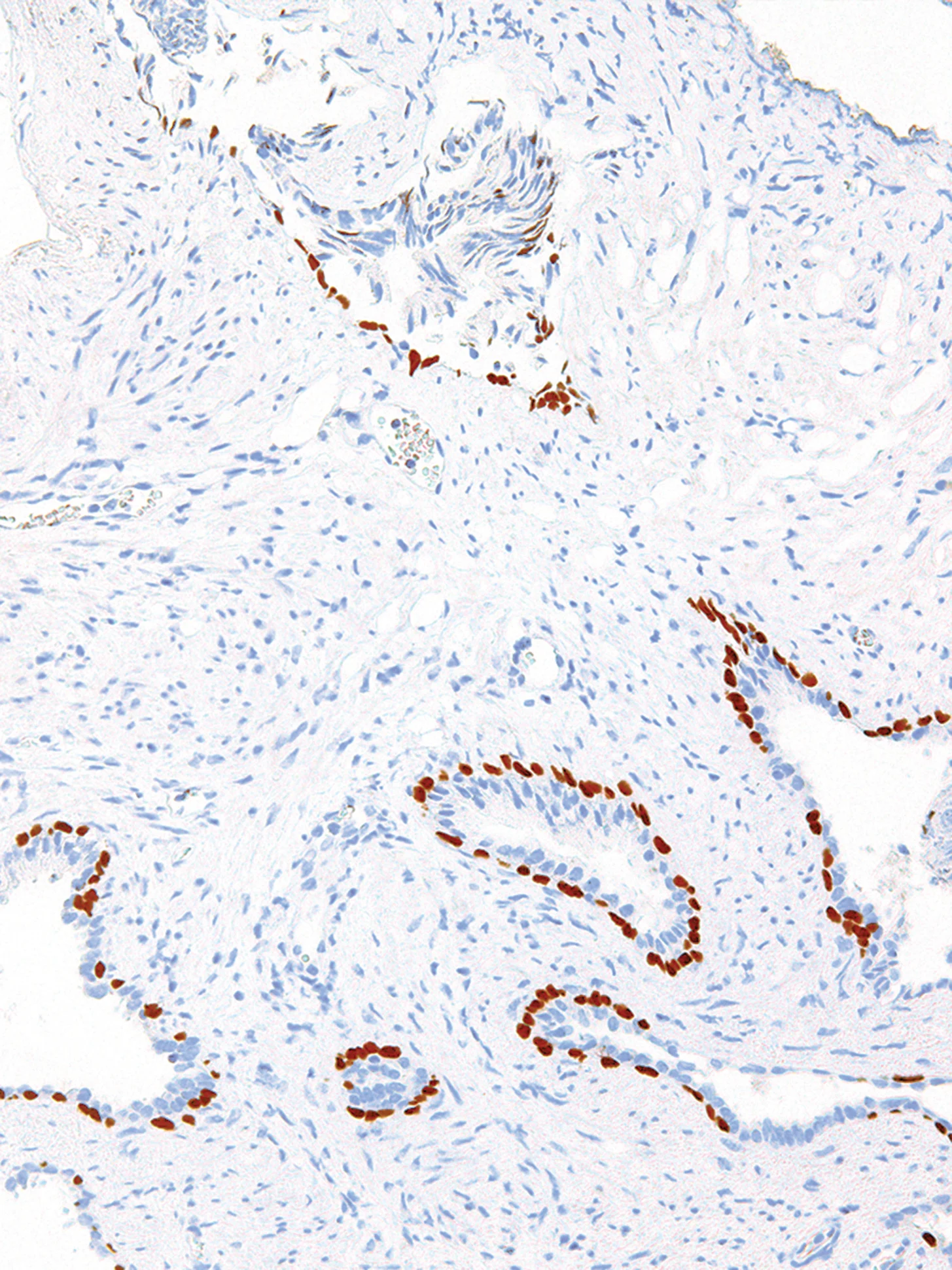 p63 Mouse Monoclonal Antibody(ARM866)