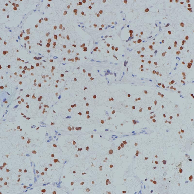 PHOX2B Rabbit Monoclonal Antibody(ARB527)