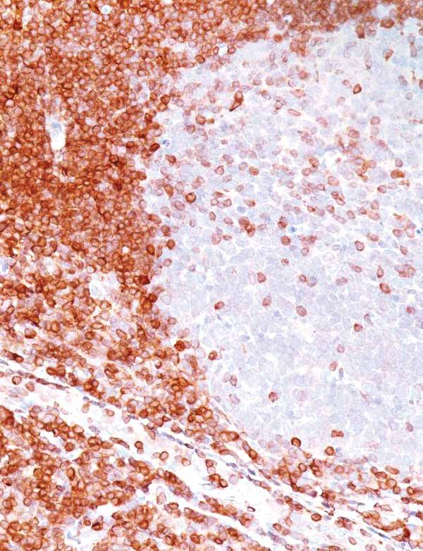 BCL-2 Mouse Monoclonal Antibody(ARM910)