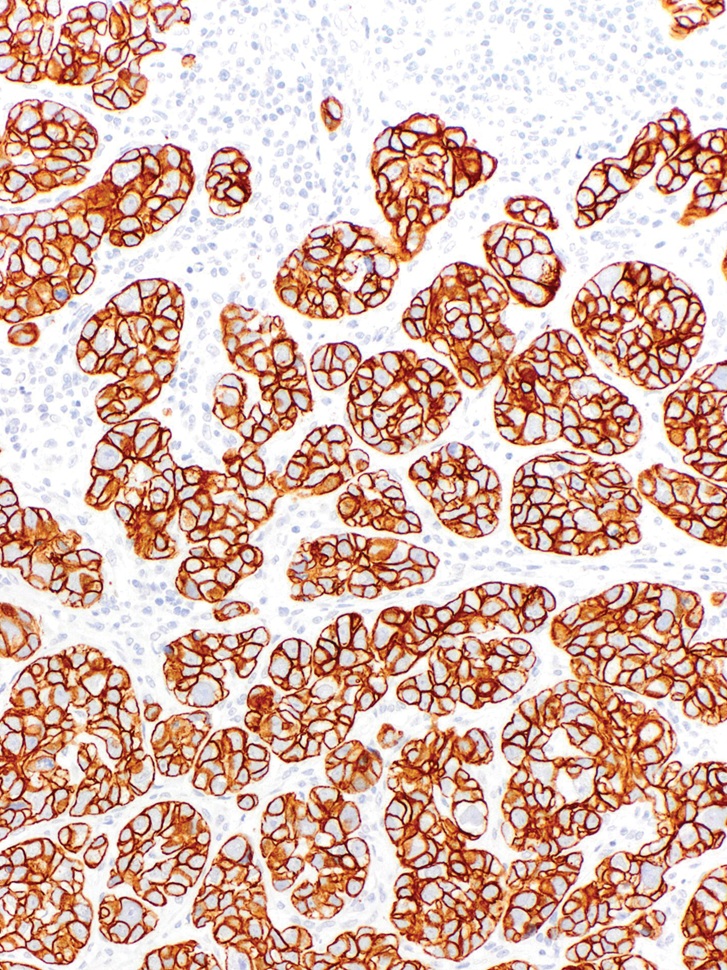 Cytokeratin 8/18 Rabbit/Mouse Monoclonal Antibody(ARM891)