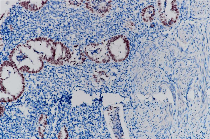 PAX-2 Rabbit Monoclonal Antibody(ARB521)