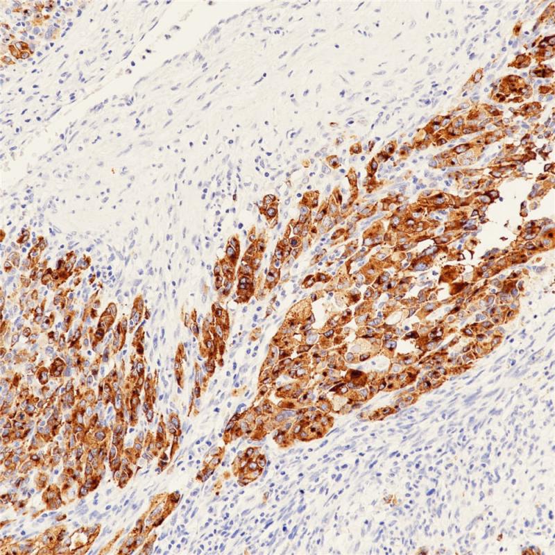 PMEL17 Rabbit Monoclonal Antibody(ARB530)