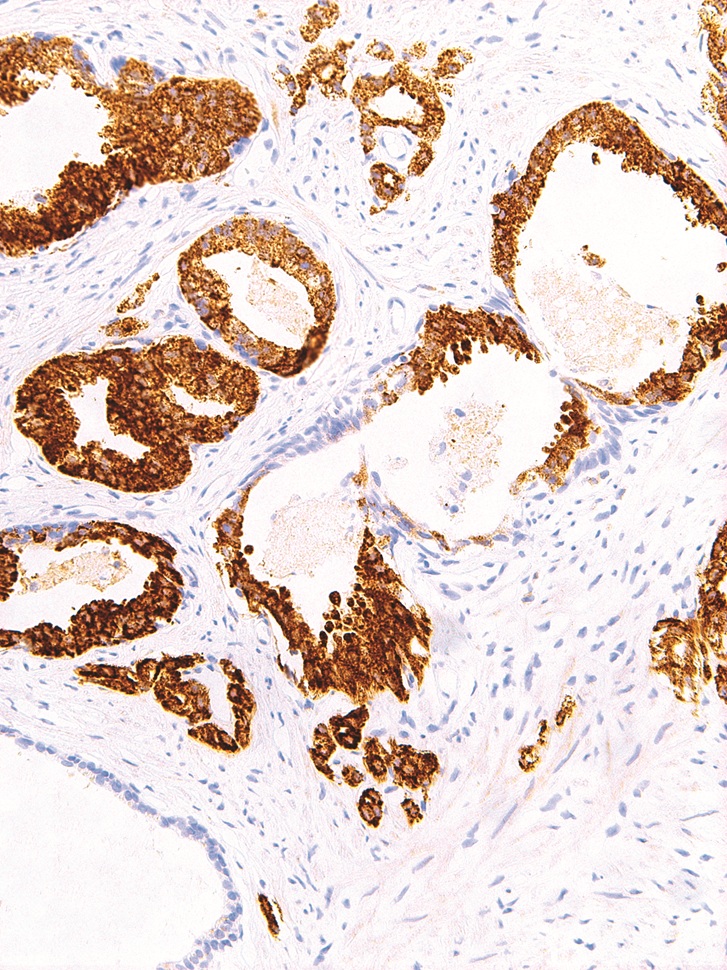 p504s/AMACR Rabbit Monoclonal Antibody(ARM885)