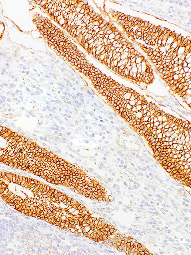 Beta-Catenin Mouse Monoclonal Antibody(ARM928)