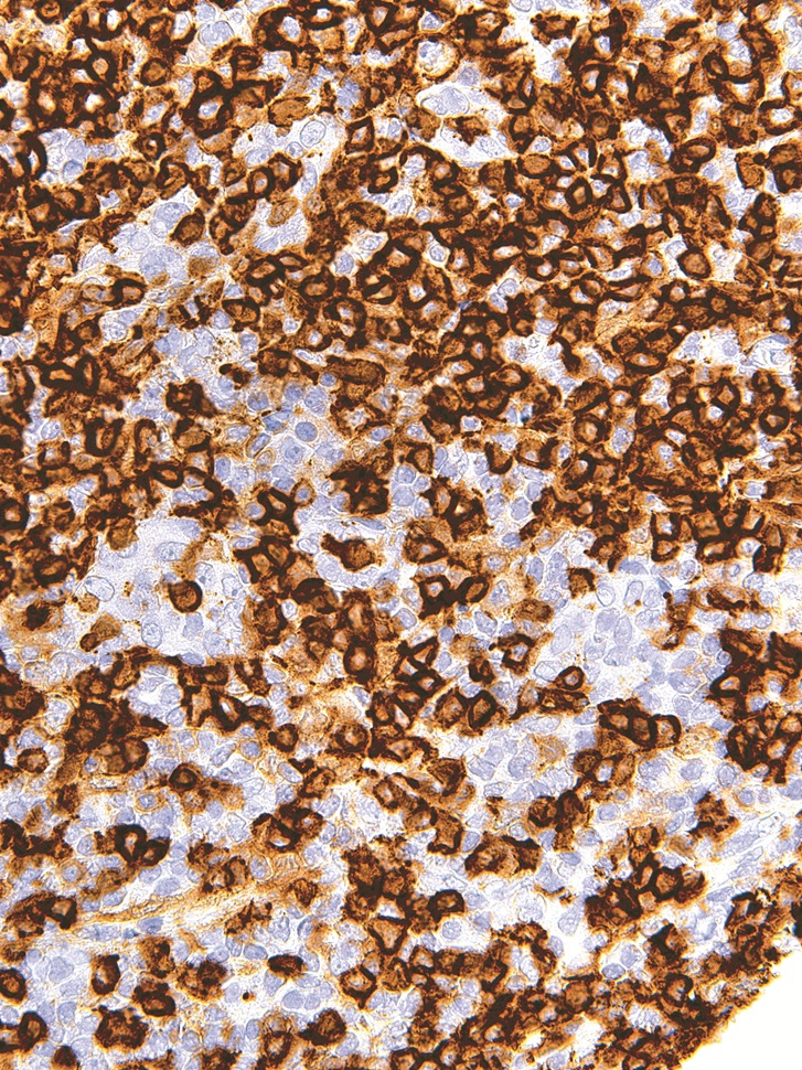 CD45RA Mouse Monoclonal Antibody(ARM952)