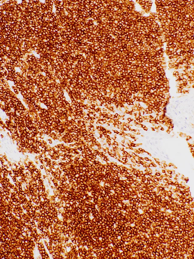 CD45 (LCA) Mouse Monoclonal Antibody(ARM951)