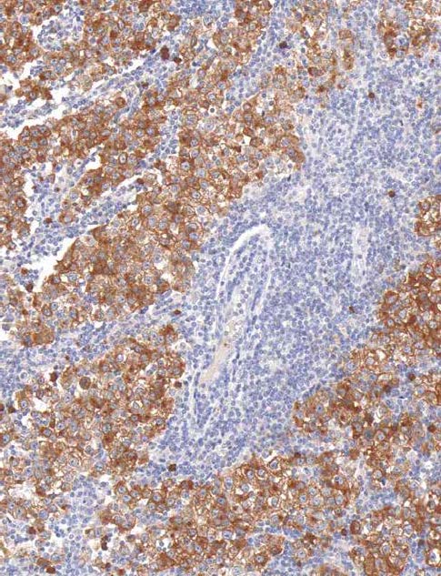 Podoplanin Mouse Monoclonal Antibody(ARM915)