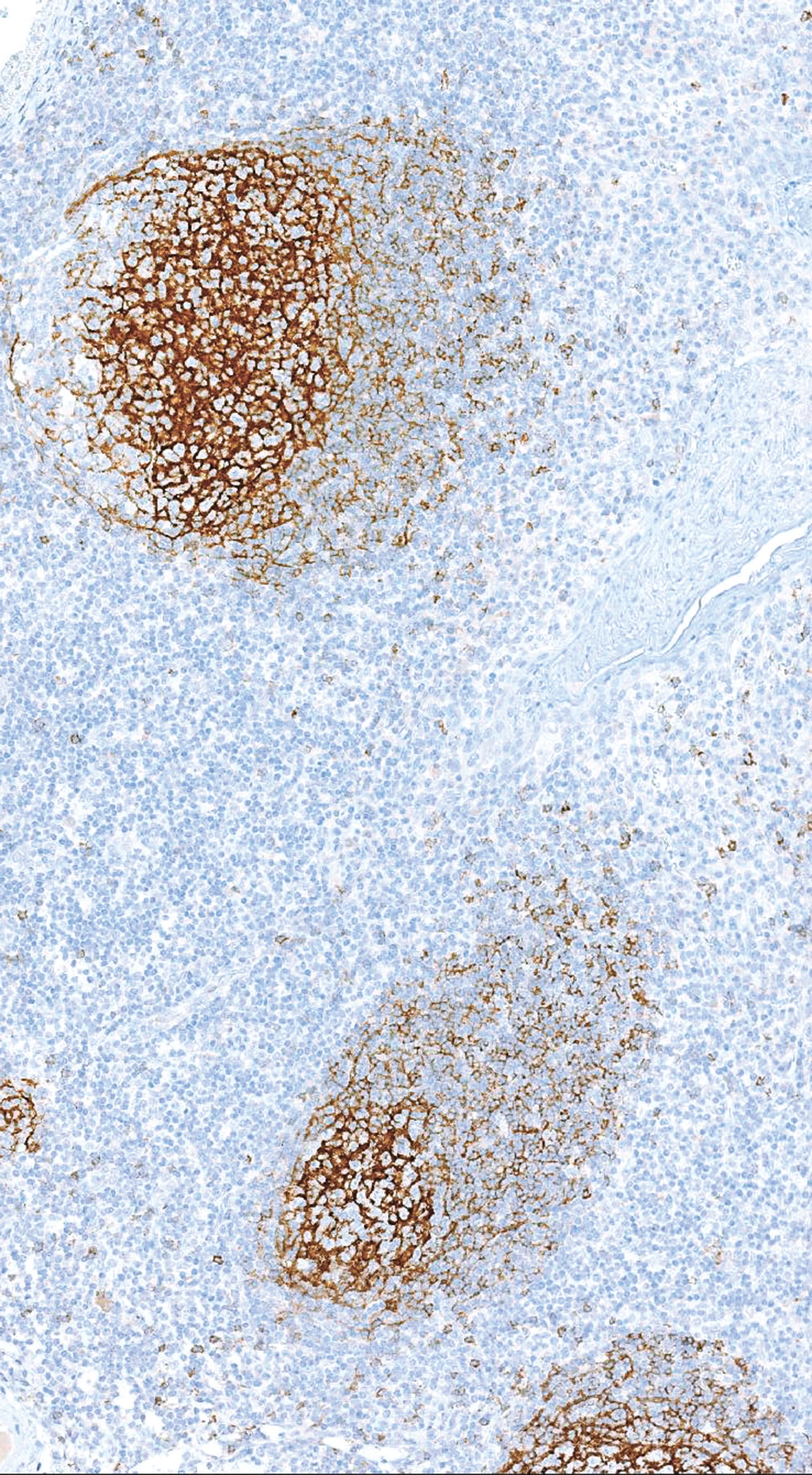 CD23 Rabbit Monoclonal Antibody(ARM944)