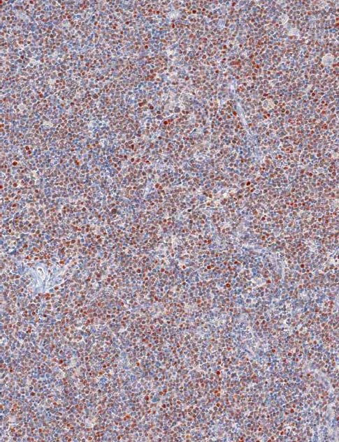 SOX11 Mouse Monoclonal Antibody(ARM916)