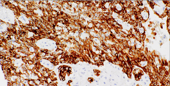 CK(AE1) Mouse Monoclonal Antibody(ARM964)