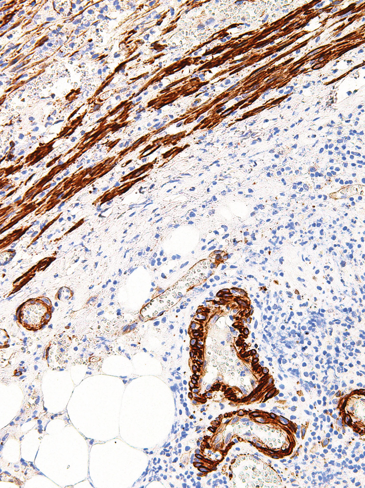 Caldesmon Mouse Monoclonal Antibody(ARM934)
