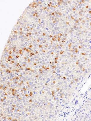 CD1a Mouse Monoclonal Antibody(ARM940)