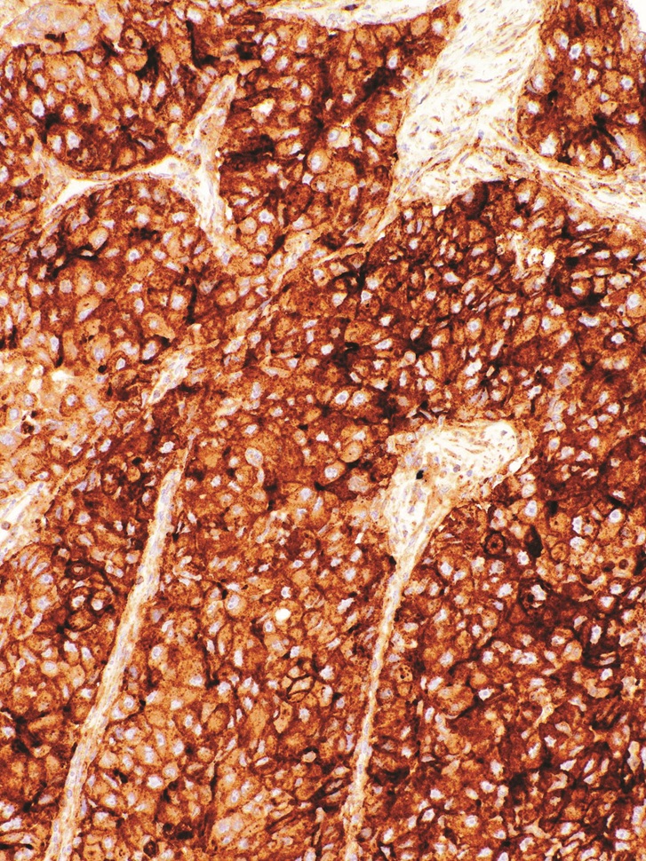 CD317 Mouse Monoclonal Antibody(ARM947)
