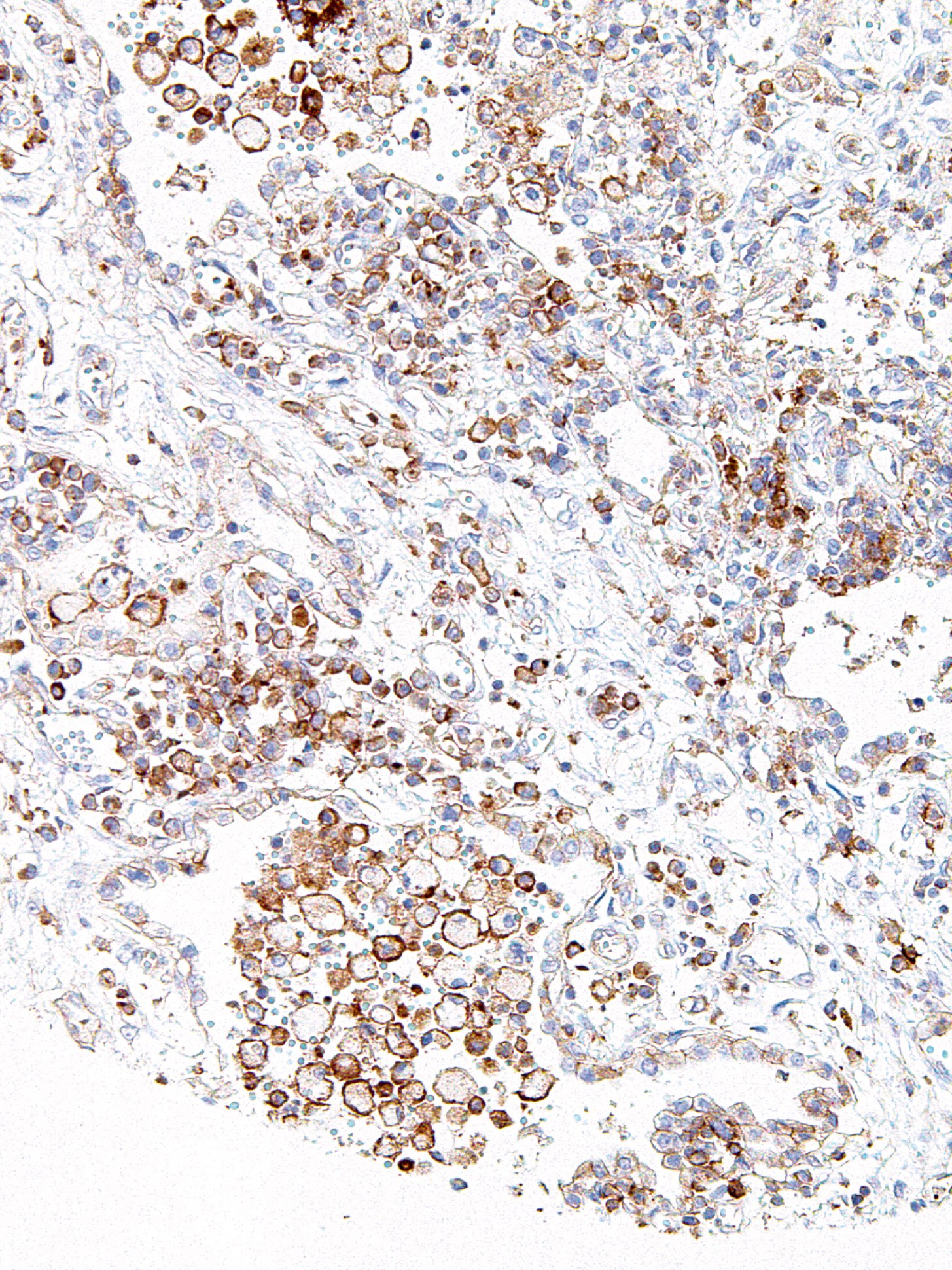 CMTM6 Mouse Monoclonal Antibody(ARM967)