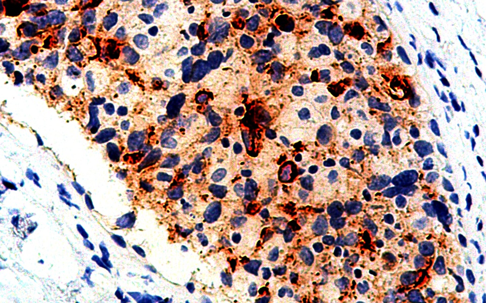 BCA-225 Mouse Monoclonal Antibody(ARM926)