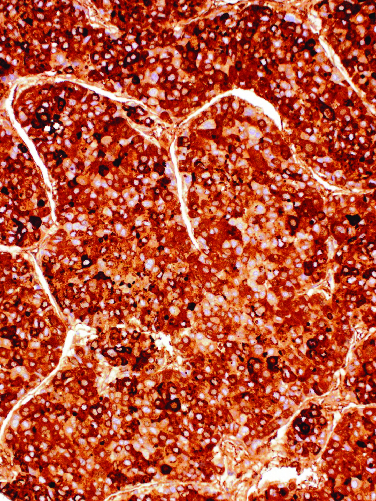 Alpha-Fetoprotein Mouse Monoclonal Antibody(ARM922)