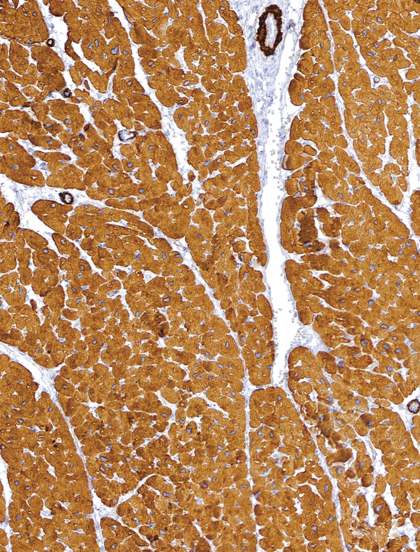 Actin, Muscle Specific Mouse Monoclonal Antibody(ARM918)