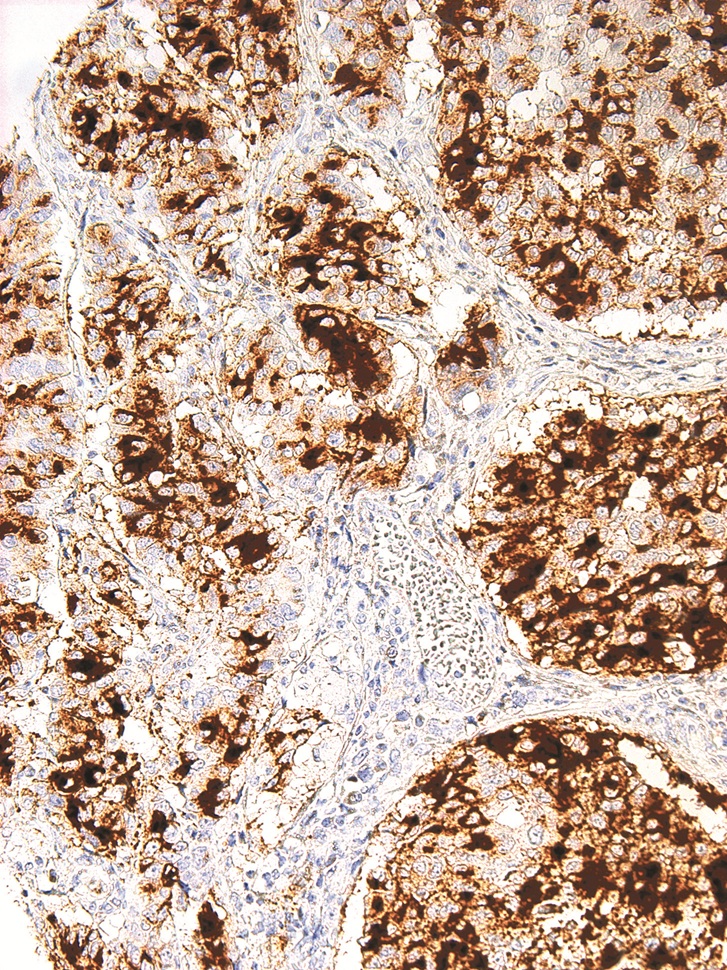 BG8, Lewis^y^ Mouse Monoclonal Antibody(ARM929)