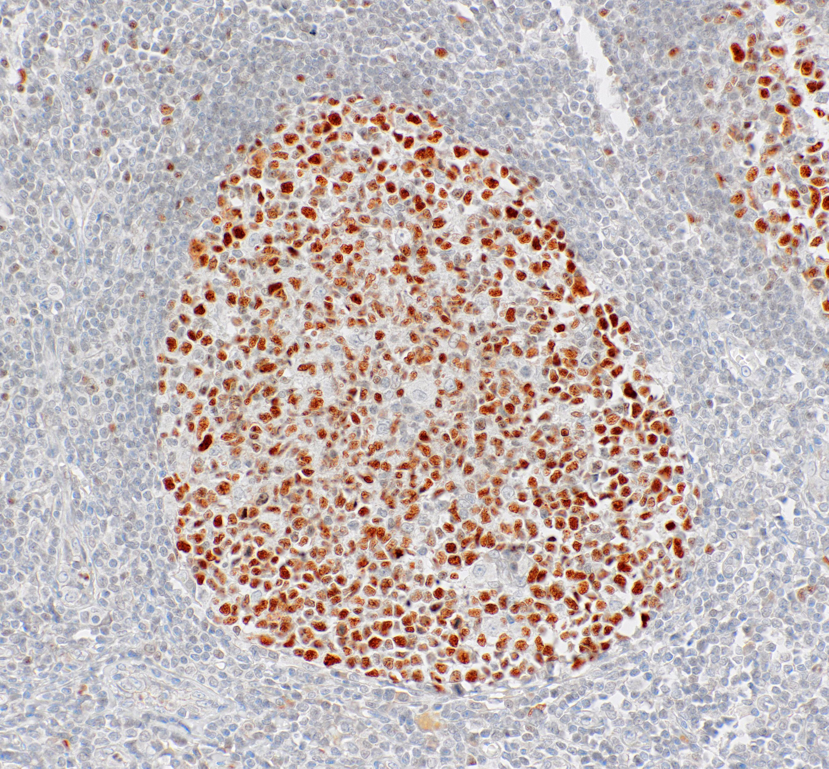 BCL6 Mouse Monoclonal Antibody(ARM927)