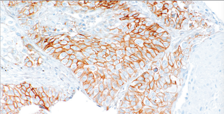 CD99 Rabbit Monoclonal Antibody(ARM962)
