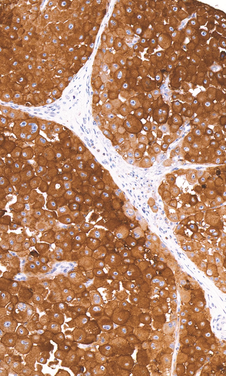 CD63 Mouse Monoclonal Antibody(ARM956)