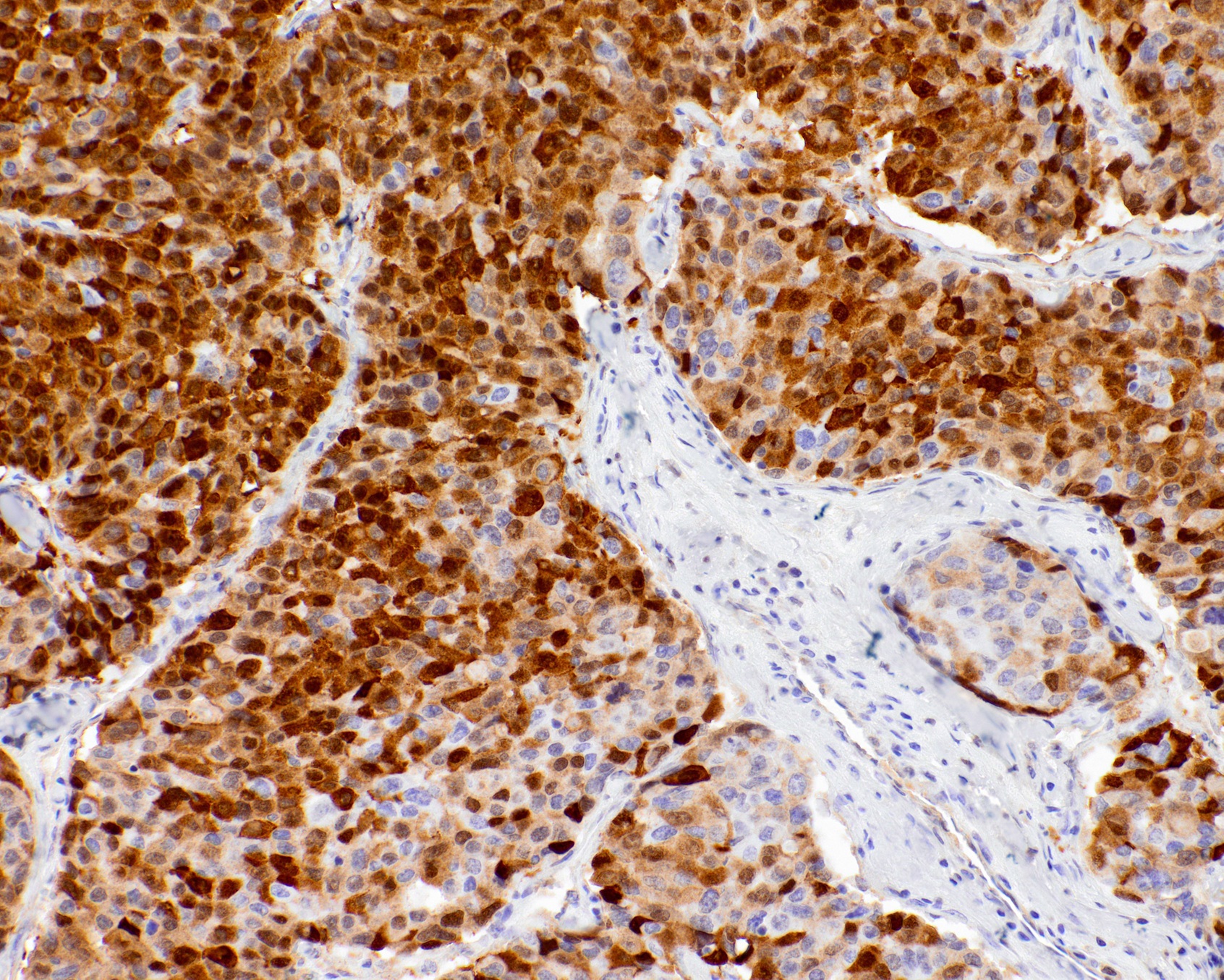Arginase-1 (ARG1) Rabbit Monoclonal Antibody(ARM925)