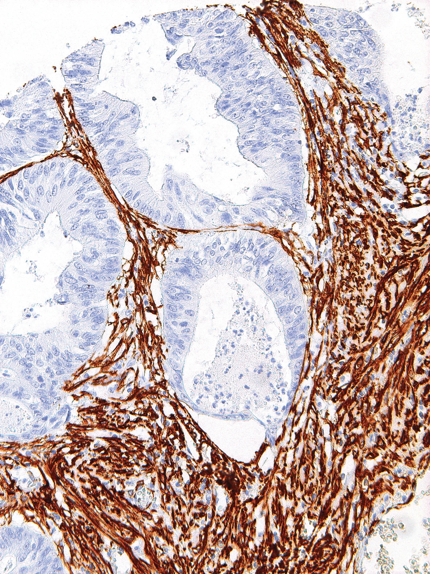 Actin, Smooth Muscle Mouse Monoclonal Antibody(ARM919)