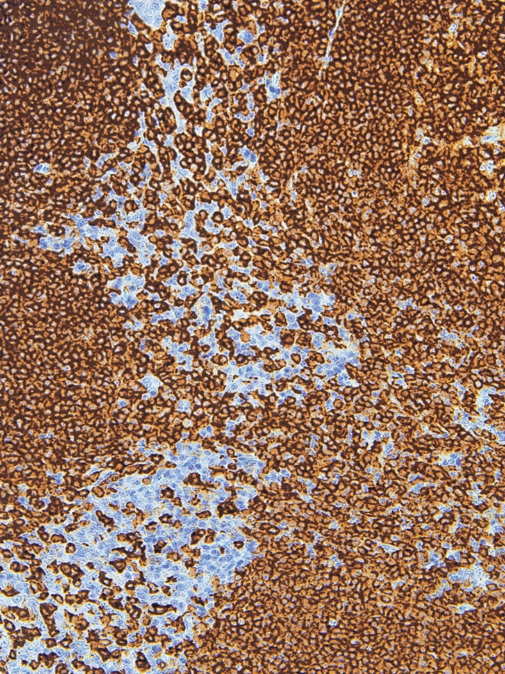 CD20 Mouse Monoclonal Antibody(ARM942)